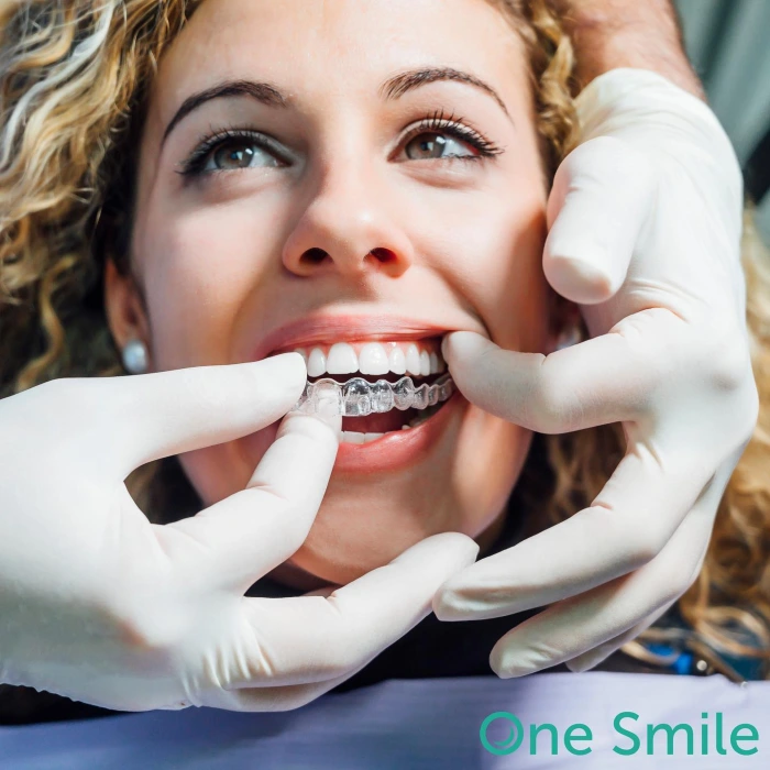 ilustracija-zubnih-implantata-donje-vilice